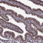 FTO Antibody in Immunohistochemistry (Paraffin) (IHC (P))