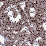 FTO Antibody in Immunohistochemistry (Paraffin) (IHC (P))