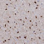 CPI-17 Antibody in Immunohistochemistry (Paraffin) (IHC (P))