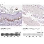 COL7A1 Antibody