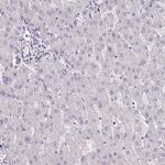 COL7A1 Antibody in Immunohistochemistry (Paraffin) (IHC (P))