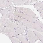 COL7A1 Antibody in Immunohistochemistry (Paraffin) (IHC (P))