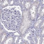 MND1 Antibody in Immunohistochemistry (Paraffin) (IHC (P))