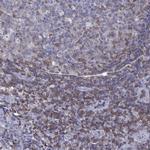 MND1 Antibody in Immunohistochemistry (Paraffin) (IHC (P))