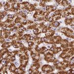 ATP5A1 Antibody in Immunohistochemistry (Paraffin) (IHC (P))