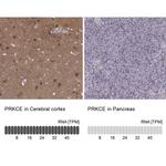 PKC epsilon Antibody