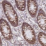 DLD Antibody in Immunohistochemistry (Paraffin) (IHC (P))