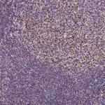 DLD Antibody in Immunohistochemistry (Paraffin) (IHC (P))