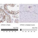 GTF2H1 Antibody