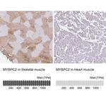 MYBPC2 Antibody