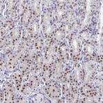 FOXA1 Antibody in Immunohistochemistry (Paraffin) (IHC (P))