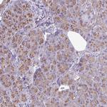 Clathrin Light Chain A Antibody in Immunohistochemistry (Paraffin) (IHC (P))