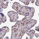 Clathrin Light Chain A Antibody in Immunohistochemistry (Paraffin) (IHC (P))