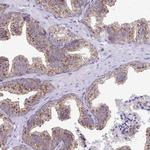 Clathrin Light Chain A Antibody in Immunohistochemistry (Paraffin) (IHC (P))