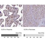 Clathrin Light Chain A Antibody