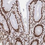 hnRNP L Antibody in Immunohistochemistry (Paraffin) (IHC (P))