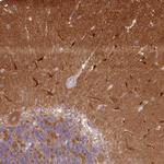 CaMKII alpha Antibody in Immunohistochemistry (Paraffin) (IHC (P))