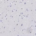 AKR1B1 Antibody in Immunohistochemistry (Paraffin) (IHC (P))