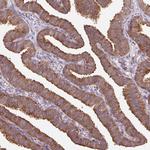 HFE Antibody in Immunohistochemistry (Paraffin) (IHC (P))