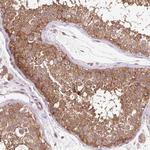 HFE Antibody in Immunohistochemistry (Paraffin) (IHC (P))