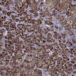 FDXR Antibody in Immunohistochemistry (Paraffin) (IHC (P))