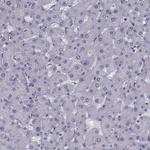 FDXR Antibody in Immunohistochemistry (Paraffin) (IHC (P))