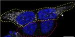 NDUFS2 Antibody in Immunocytochemistry (ICC/IF)