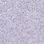 Cardiac Troponin C Antibody in Immunohistochemistry (Paraffin) (IHC (P))