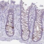 Cyclin B1 Antibody in Immunohistochemistry (Paraffin) (IHC (P))