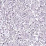 Cyclin B1 Antibody in Immunohistochemistry (Paraffin) (IHC (P))