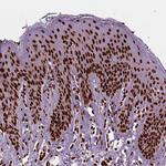 BRD4 Antibody in Immunohistochemistry (Paraffin) (IHC (P))