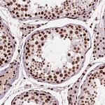 BRD4 Antibody in Immunohistochemistry (Paraffin) (IHC (P))