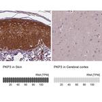 PKP3 Antibody