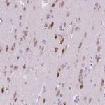 ELAVL2 Antibody in Immunohistochemistry (Paraffin) (IHC (P))