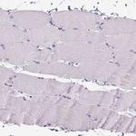 ELAVL2 Antibody in Immunohistochemistry (Paraffin) (IHC (P))