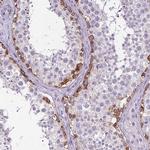 ELAVL2 Antibody in Immunohistochemistry (Paraffin) (IHC (P))