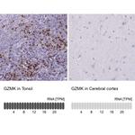 Granzyme K Antibody