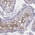 LRRC50 Antibody in Immunohistochemistry (Paraffin) (IHC (P))