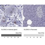 Norepinephrine Transporter Antibody