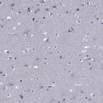 Nkx3.1 Antibody in Immunohistochemistry (Paraffin) (IHC (P))