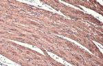 Alpha-Smooth Muscle Actin Antibody in Immunohistochemistry (Paraffin) (IHC (P))