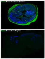 Alpha-Smooth Muscle Actin Antibody