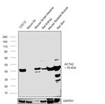 Alpha-Smooth Muscle Actin Antibody in Western Blot (WB)