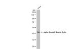 Alpha-Smooth Muscle Actin Antibody in Western Blot (WB)