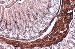 Alpha-Smooth Muscle Actin Antibody in Immunohistochemistry (Paraffin) (IHC (P))