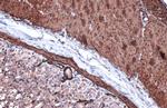 Alpha-Smooth Muscle Actin Antibody in Immunohistochemistry (Paraffin) (IHC (P))