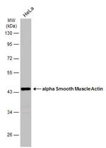 Alpha-Smooth Muscle Actin Antibody in Western Blot (WB)