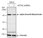 Alpha-Smooth Muscle Actin Antibody in Western Blot (WB)