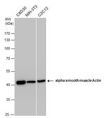 Alpha-Smooth Muscle Actin Antibody in Western Blot (WB)