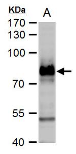 B-Raf Antibody in Western Blot (WB)